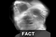 FACT